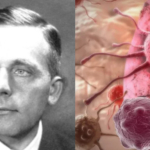 Bunuh Mati Sel Kanker, Begini Caranya