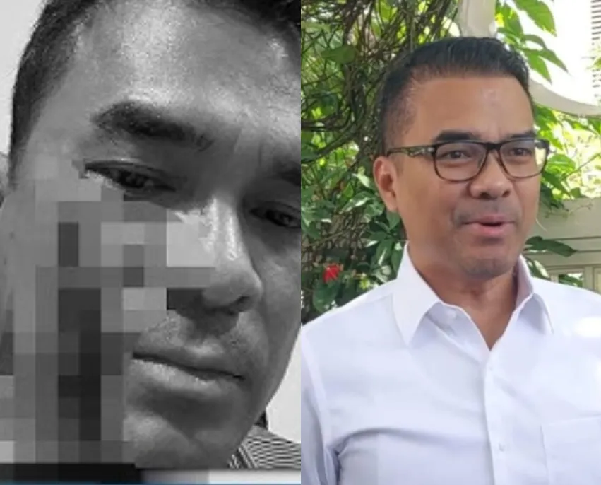 Luka Dipelipis, Waketum PSI Alami Pengeroyokan Di Depan Babinsa