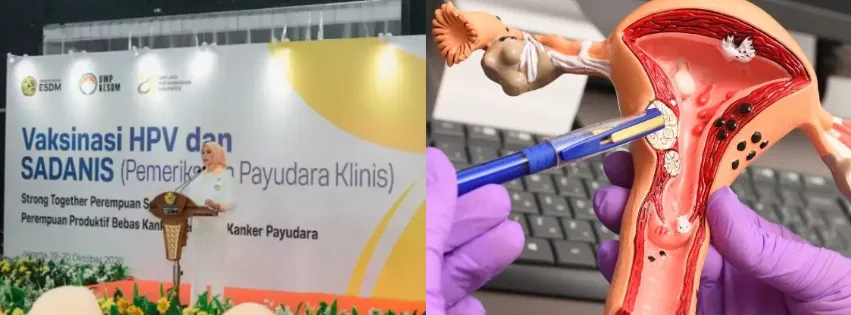 Cegah Kanker Serviks Sejak Dini, Sri Suparni Bahlil Ajak Perempuan Ikut Vaksinasi HPV